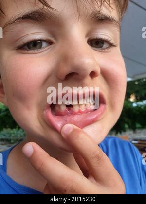 Ragazzo con fessura tra i denti del latte, ritratto, Germania Foto Stock