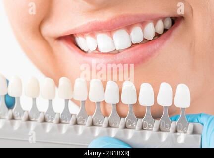 Bel sorriso e denti bianchi di una giovane donna. Matching le sfumature delle protesi mammarie o il processo di sbiancamento dei denti. Foto Stock