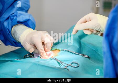 Processo operativo su un paziente. Le mani del chirurgo nei guanti protettivi che fanno l'ambulatorio con gli attrezzi medici. Foto Stock