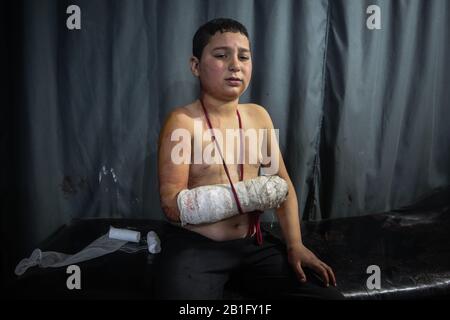 Maarrat Misrin, Siria. 25th Feb, 2020. Un ragazzo siriano riceve un trattamento dopo che ha ferito durante un attacco aereo, presumibilmente effettuato da forze siriane belliche ha colpito una scuola abitata da sfollati nella provincia di Idlib, tenuta dai ribelli. Credito: Anas Alkforhoutli/Dpa/Alamy Live News Foto Stock