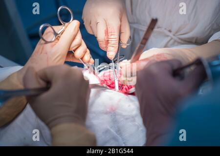 Il team di chirurghi facendo un'operazione. Sterile di sala operatoria. La chirurgia del rene in un piccolo paziente. Le procedure chirurgiche operazione diagnostica Foto Stock