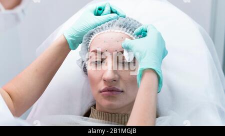 Il giovane medico estetista che si prepara a fare l'iniezione nella fronte femminile. Il medico cosmetologo fa il trattamento anti-invecchiamento e l'alzata del viso proced Foto Stock