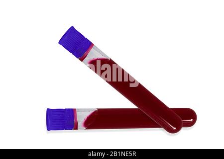 Provette per analisi del sangue in laboratorio isolate su bianco Foto Stock