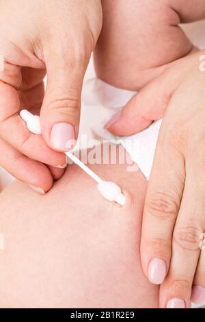 Madre Pulisce L'ombelico Neonato Con Tampone Di Cotone Immagine Stock -  Immagine di pediatra, igiene: 173871649