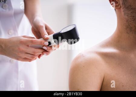 Close-up di persona le mani esaminando l'Acne pelle dell uomo con Dermatoscope Foto Stock