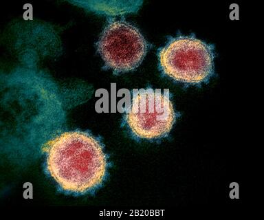 COVID-19. Nuova immagine per microscopio elettronico a trasmissione Coronavirus SARS-COV-2. Questa immagine per microscopio elettronico a trasmissione mostra SARS-COV-2, noto anche come 2019-nCoV, il virus che causa COVID-19. Isolato da un paziente negli Stati Uniti, che emerge dalla superficie delle cellule coltivate in laboratorio. Credito: NIAID-RML Foto Stock