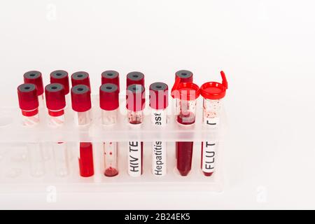 provette per analisi con campioni di sangue e scritte isolate su bianco Foto Stock