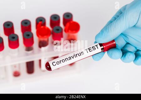 fuoco selettivo dello scienziato che contiene il campione con la scritta di test del coronavirus vicino alle provette di test isolate su bianco Foto Stock