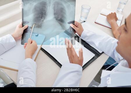 Radiografia polmonare del paziente con polmonite nelle mani di medici generici che discutono i sintomi Foto Stock