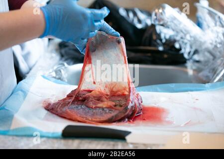 Mani con guanti che tengono aperta la sacca amniotica attaccata alla placenta. Foto Stock