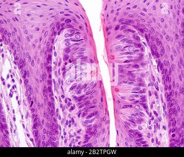 Micrografia leggera ad alto ingrandimento che mostra diverse papille gustative con i loro pori gustativi o gustativi. Colorazione H&E. Foto Stock