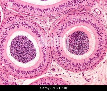 Due sezioni del condotto epididimale circondate da strati concentrici di tessuto fibromuscolare. L'epitelio pseudostratificato è costituito da un alto colonnare Foto Stock