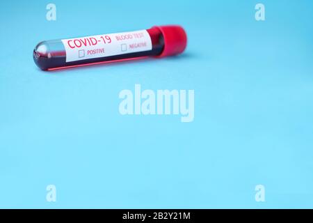 Provetta con sangue per il test Covid-19. Malattia del virus Corona 2019 concetto di analisi del sangue. Malattia di coronavirus. Test del sangue per risultati positivi o negativi. Spazio di copia Foto Stock