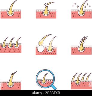 Perdita di capelli RGB icone di colore impostato. Capelli danneggiati, radici malsane. Cuoio capelluto e follicolo. Tessuto cutaneo. Trattamento dermatologico, problema di cura di haircare. Alopecia e. Illustrazione Vettoriale