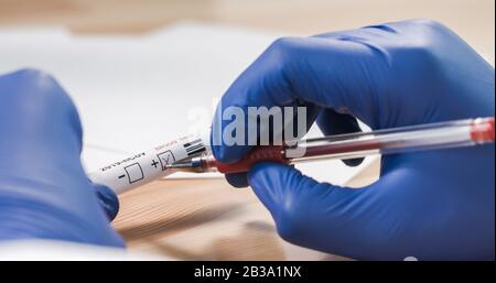 Il medico che indica Coronavirus Positivo sulla provetta per analisi del sangue. Epidemia E Epidemia Di Virus. Foto Stock