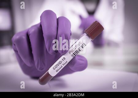 Campione Di Sangue Infetto Di Coronavirus Covid-19 Nelle Mani Di Doctor Scientist. Epidemia E Epidemia Di Virus. Foto Stock