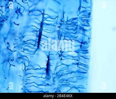 Micrografia leggera ad alto ingrandimento che mostra osteociti colorati con la tecnica di Schmul. Dal suo corpo cellulare allungato, molte processe sottili e lunghe Foto Stock