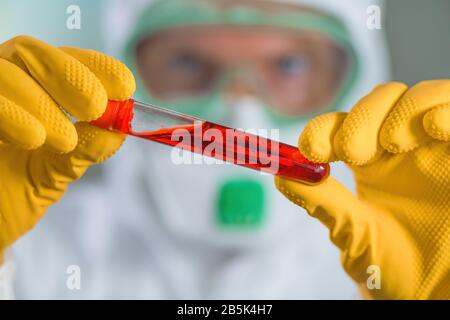 Epidemiologist che esamina la provetta di analisi del campione medico in quarantena virale, testando il sangue del paziente durante l'epidemia di infezione virale Foto Stock