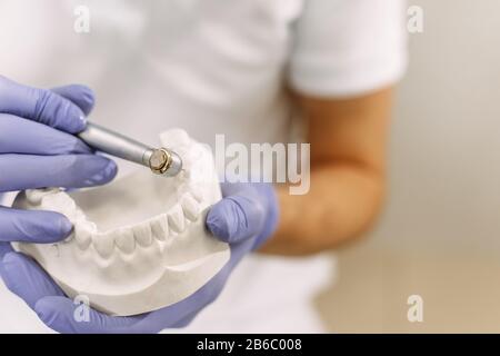 Dentista concentrato con campioni di mascelle modello di dente in studio dentistico professionale clinica dentale. Il dentista tiene un trapano con un impianto. Primo piano. Foto Stock