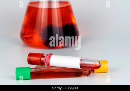 Campioni di sangue per analisi di laboratorio per la presenza di coronavirus COVID-19. Pallone chimico con molecole del virus. Foto Stock