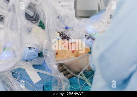 Il processo di esecuzione di un intervento chirurgico utilizzando un moderno sistema chirurgico robotico. Robot medico. Chirurgia robotica minimamente invasiva. Foto Stock