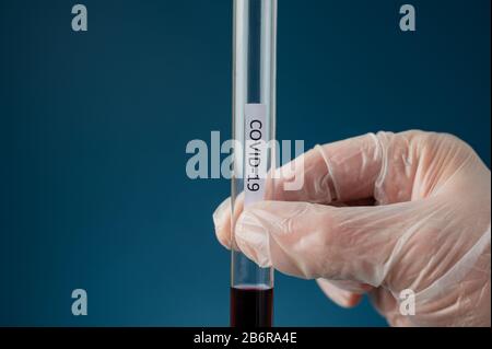 Mano di un medico che indossa un guanto di protezione che contiene una provetta di vetro con campione di sangue e un segno di Covid 19 su di essa. Foto Stock