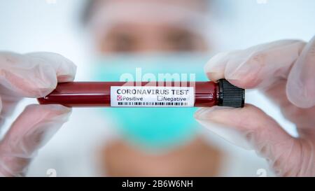 Donna asiatica con provetta positiva di campione di sangue infetto per COVID-19, nuovo coronavirus trovato a Wuhan, Cina. Scienziato con guanti bianchi e ma Foto Stock