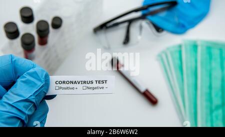 Scienziato con guanti blu, etichetta identificativa per test COVID-19, campione di laboratorio di analisi del sangue per la diagnosi di nuova infezione da virus Corona. Dis Foto Stock