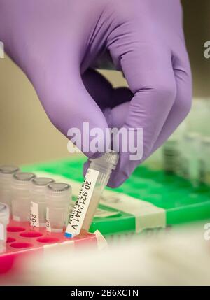 I campioni sono testati per virus respiratori durante una visita del Cancelliere Rishi Sunak ai laboratori di patologia presso l'infermeria generale di Leeds. Si tratta della stessa procedura che verrà utilizzata dal laboratorio quando inizia a ricevere campioni di coronavirus per l'analisi. Foto Stock