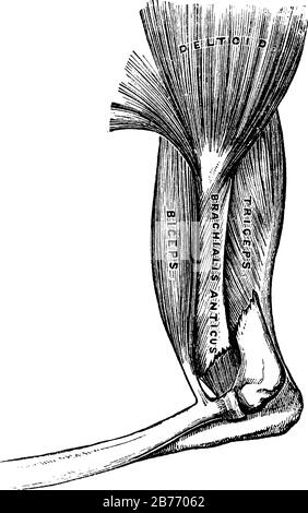 I muscoli del braccio comprendono il muscolo deltoide, il muscolo bicipite e il muscolo tricipite. Un osso è fratturato vicino al gomito, al disegno di linee vintage o all'incisione dell'illusta Illustrazione Vettoriale