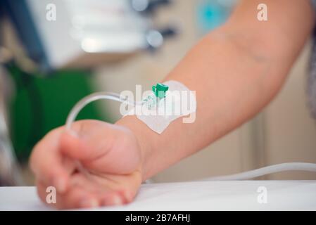 Liquido per via endovenosa, per via endovenosa, con sodio cloruro applicato alla mano del paziente in ospedale. Foto Stock