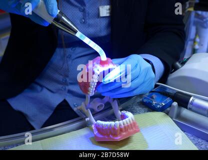 Donna mani in guanti blu che brillano sul moulage di plastica di mascelle e denti umani - typodont - con la lampada di fotopolimero. Mostra modo di trattamento dentale Foto Stock