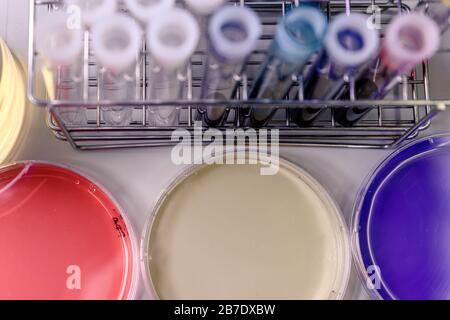 Piastre di Petri, provette e attrezzature da laboratorio, con liquidi coloranti. Concetto di scienza, laboratorio e studio delle malattie. Foto Stock