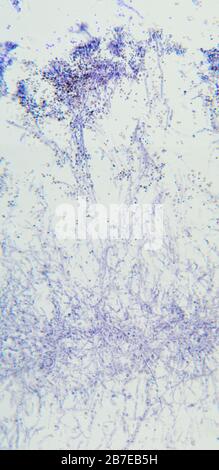 Penicillium, funghi ascomiceti, dettaglio, al microscopio. Per gli esseri umani gli ascomiceti sono una fonte di composti medicinali, come gli antibiotici. Foto Stock