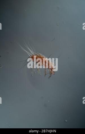 La polvere si acita al microscopio 100x Foto Stock