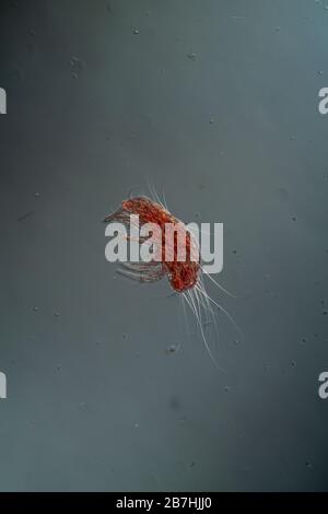 La polvere si acita al microscopio 100x Foto Stock