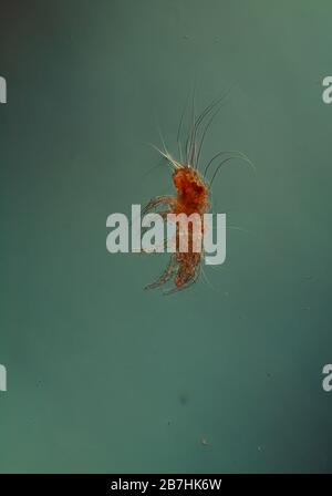 La polvere si acita al microscopio 100x Foto Stock