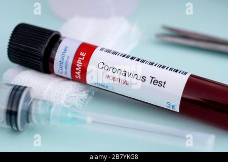 Test per la presenza di coronavirus. Siringa con vaccino e provetta contenente un campione di sangue risultato positivo per COVID-19. Foto Stock