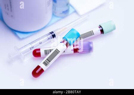 Donazione di sangue per la ricerca sulle sostanze immunitarie contro il Coronavirus. Immagine concettuale per la Giornata Mondiale dei donatori di sangue 14 giugno. Foto Stock