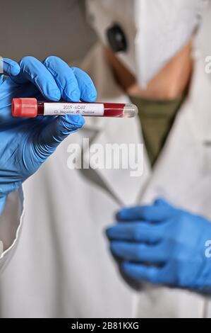 Coronavirus 2019-Ncov con analisi del sangue positiva Foto Stock