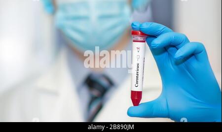 Primo piano della mano del medico con test del sangue positivo per un nuovo coronavirus a rapida diffusione originario di Wuhan, Cina Foto Stock