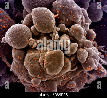 Una micrografia elettronica a trasmissione di COVID-19, nuovo coronavirus, una cellula apoptotica fortemente infettata con particelle di virus SARS-COV-2, isolata da un campione di paziente presso il NIAID Integrated Research Facility 19 marzo 2020 a Fort Detrick, Maryland. Foto Stock