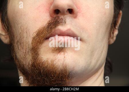 La parte inferiore del volto di un uomo bianco. Metà del viso è rasata, l'altra metà con barba e baffi Foto Stock