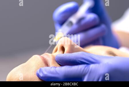 Primo piano dell'aumento del labbro con ago di iniezione nel salone di bellezza o nella clinica di chirurgia plastica dal medico. Iniezione di labbra con siringa riempitrice per donna. Foto Stock