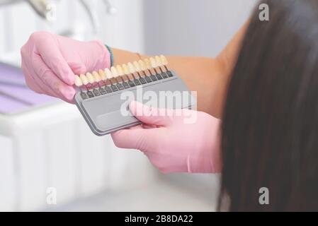 Concetto di cura dentale. Il dentista tiene le mani con un set di impianti con varie sfumature di tono e mostra al paziente Foto Stock