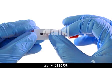 Mani in guanti blu, tenere il tubo medico con sangue reale. Incollano il collegamento HEPATITIS. Isolato su uno sfondo bianco Foto Stock