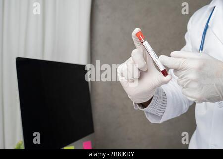 Primo piano delle mani del medico maschile asiatico. Prende sangue di coronavirus del paziente nella provetta dell'ospedale. Foto Stock