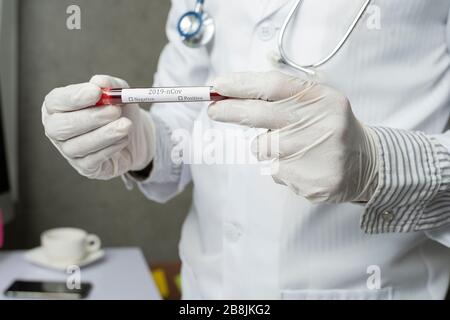 Primo piano delle mani del medico maschile asiatico. Prende sangue di coronavirus del paziente nella provetta dell'ospedale. Foto Stock