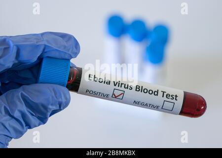 Risultato positivo degli esami del sangue per il virus Ebola, malattia da virus Ebola (EVD) Foto Stock