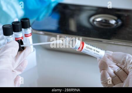 Chiusura di un test di prova per la presenza di coronavirus. Provetta contenente un tampone per il test COVID-19. Foto Stock